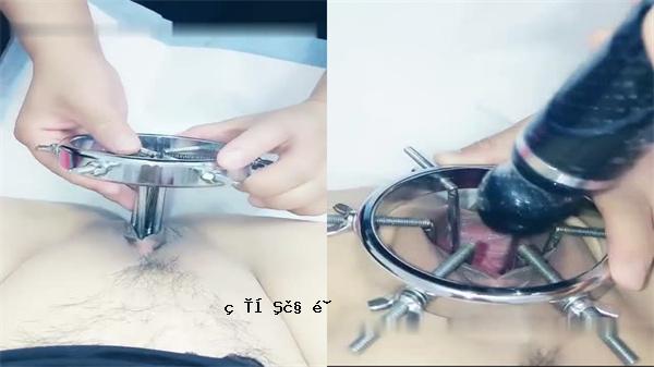 周焕林尿道开口试验